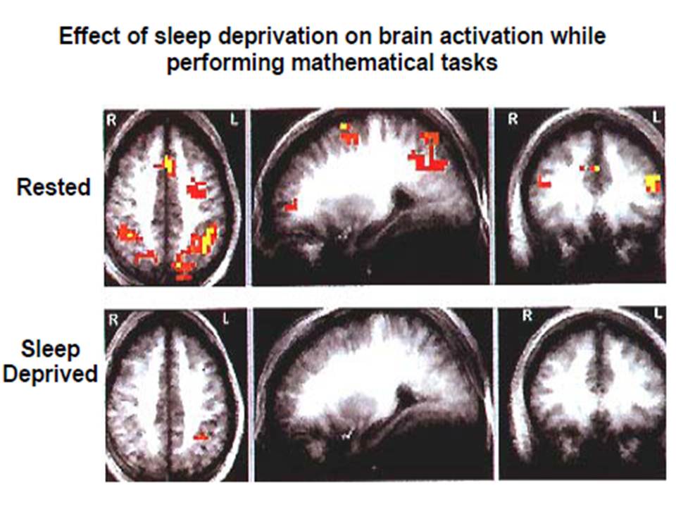 The Power Of A Good Night’s Sleep: The Correlation Between Quality ...